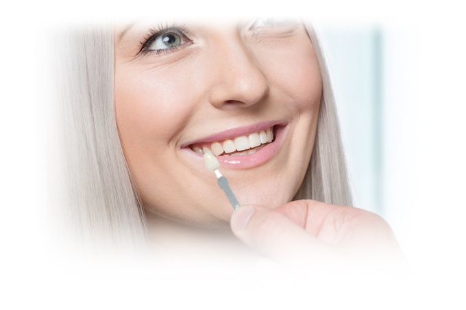 Dental veneers treatment